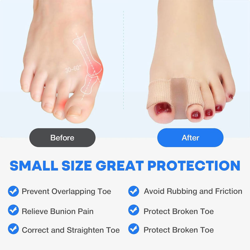 🦶✨ Zehenspreizer & Ballenkorrektur – Schmerzfreie Linderung bei Hallux valgus & überlappenden Zehen für Frauen & Männer! ✨👟
