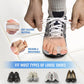 🦶✨ Zehenspreizer & Ballenkorrektur – Schmerzfreie Linderung bei Hallux valgus & überlappenden Zehen für Frauen & Männer! ✨👟